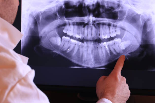 Best Knocked-Out Tooth Emergency  in Midvale, UT